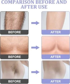 Livingful Premium Crystal Hair Removal • Pijnloos Ontharing Epileerapparaat Voor Armen Benen Rug• Mannen En Vrouwen • Epilator Voor Langdurige Ontharing • Snelle En Gemakkelijke Exfoliërende Ontharin • Haarverwijderaar • Kristalpad • Zijdezachte Huid -Verzorgingsproducten 1005x1200 2