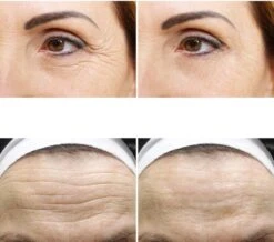 Simia™ Anti Rimpel Beauty Pads - Face Set (7 Stuks) - Voorhoofd Mond & Ogen - Herbruikbaar Anti Aging Siliconen Pad Tegen Lijntjes En Rimpels -Verzorgingsproducten 1200x1058 1