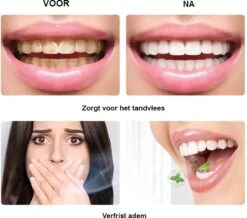 BOR Tanden Bleekpen - Tanden Bleken - Tandenbleekset - Whitening Pen - Tandenblekers - Wittere Tanden - Teeth Whitening Pen - Tanden Bleker -Verzorgingsproducten 1200x1061