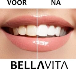 BELLAVITA Tandenbleekset - Tanden Bleken - Teeth Whitening Kit - Tandenblekers - 4 Gelpennen - Zonder Peroxide - 100% Natuurlijk - Witte Tanden -Verzorgingsproducten 1200x1095 3