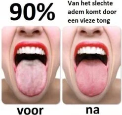 Effectieve Tongschraper (hoge Kwaliteit) - Tongreiniger Koper - Mondverzorging - Persoonlijke Verzorging – Rose Gold - Underdog Tech -Verzorgingsproducten 1200x1130 4