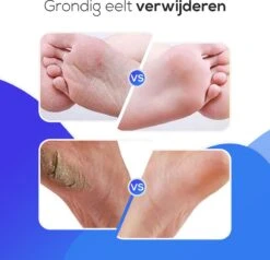 LifeWise Elektrische Eelt Verwijderaar - Voetvijl - 60 Vervangbare Schuurpads - Netstroom Adapter -Verzorgingsproducten 1200x1155 1