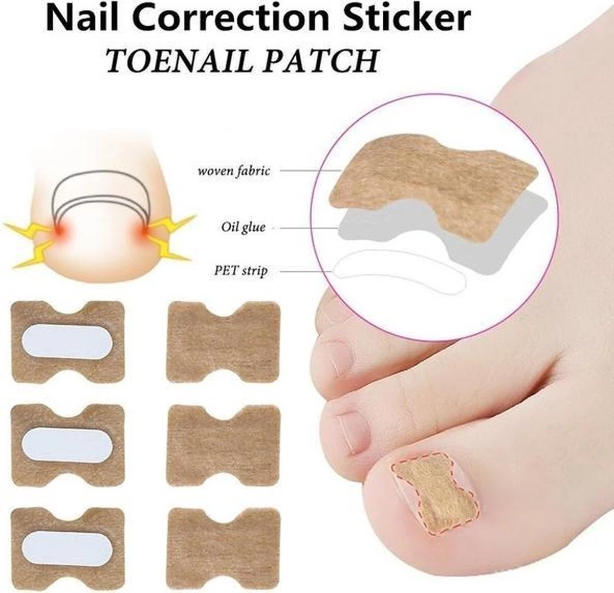 Merkloos Ingegroeide Teennagel Corrector 3 Merkloos Ingegroeide Teennagel Corrector