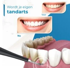 Professionele Tandsteen Verwijderaar - 5 Standen - Inclusief Tandarts Set - Met 3 Opzetstukken - Elektrisch - Tandplak -Verzorgingsproducten 1200x1163 3
