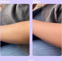 Livingful Premium Crystal Hair Removal • Pijnloos Ontharing Epileerapparaat Voor Armen Benen Rug• Mannen En Vrouwen • Epilator Voor Langdurige Ontharing • Snelle En Gemakkelijke Exfoliërende Ontharin • Haarverwijderaar • Kristalpad • Zijdezachte Huid -Verzorgingsproducten 1200x1166 7