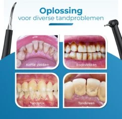 Professionele Tandsteen Verwijderaar - 5 Standen - Inclusief Tandarts Set - Met 3 Opzetstukken - Elektrisch - Tandplak -Verzorgingsproducten 1200x1169 5