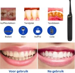 ExCorn Elektrische Tandsteen Verwijderaar - Inclusief 6-delig Tandartsset - 3 Standen - Elektrisch Tandplak Verwijderen - Tanden Polijsten -Verzorgingsproducten 1200x1173 7