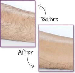 EPC® Duo Crystal Hair Removal Pad - Ontharings Pad - Pijnloos Ontharen - Kristal Haarverwijderaar - Scrubi - Ontharing Eraser Kristalpad - Bleame - Armen Benen Bikinilijn - Roze -Verzorgingsproducten 1200x1177 9