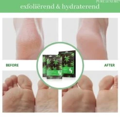 PureLuxure Voetmasker - Voetverzorging - Eeltsokken - Eelt Verwijderaar - Voetenmasker - Peel Off Masker - 1 Paar (2 Stuks) -Verzorgingsproducten 1200x1191 1