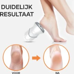 MW® Elektrische Eeltverwijderaar - Voetvijl - Eelt Verwijderaar - Elektrische Vijl - 3 Vijlschijven -Verzorgingsproducten 1200x1191