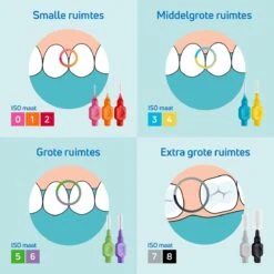TePe Interdentale Ragers Original Geel ISO Maat 2 – 0,7 Mm (20 Stuks) 10 TePe Interdentale Ragers Original Geel ISO Maat 2 – 0,7 Mm (20 Stuks) -Verzorgingsproducten 1200x1200 1009