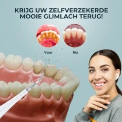 Merkloos Tandsteen Verwijderaar Elektrisch – Tandenborstel Opzetstukken - Tandarts Spiegel - 5 Standen -Wit 16 Merkloos Tandsteen Verwijderaar Elektrisch – Tandenborstel Opzetstukken - Tandarts Spiegel - 5 Standen -Wit -Verzorgingsproducten 1200x1200 1229