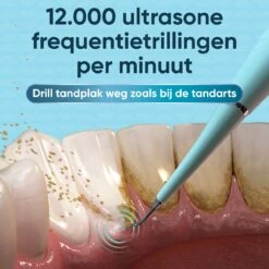 Whitee Elektrische Tandsteen Verwijderaar - Tanden Polijsten - Tandarts Tandsteenverwijderaars - Elektrisch Tandplak Verwijderen 17 Whitee Elektrische Tandsteen Verwijderaar - Tanden Polijsten - Tandarts Tandsteenverwijderaars - Elektrisch Tandplak Verwijderen -Verzorgingsproducten 1200x1200 1248