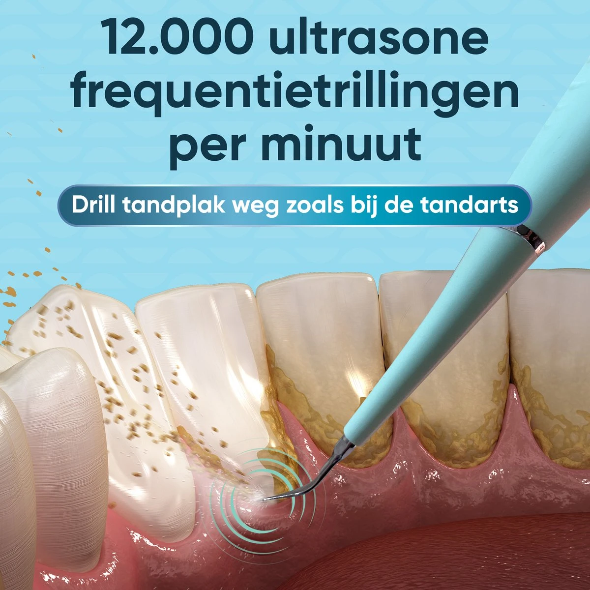 Whitee Elektrische Tandsteen Verwijderaar - Tanden Polijsten - Tandarts Tandsteenverwijderaars - Elektrisch Tandplak Verwijderen 7 Whitee Elektrische Tandsteen Verwijderaar - Tanden Polijsten - Tandarts Tandsteenverwijderaars - Elektrisch Tandplak Verwijderen - Afbeelding 5