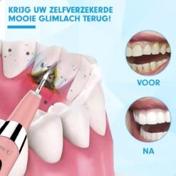 DEN-T® PRO U500 - Elektrische Sonische Tandsteen Verwijderaar - Roze -Verzorgingsproducten 1200x1200 1274