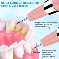 DEN-T® PRO U500 - Elektrische Sonische Tandsteen Verwijderaar - Roze -Verzorgingsproducten 1200x1200 1276