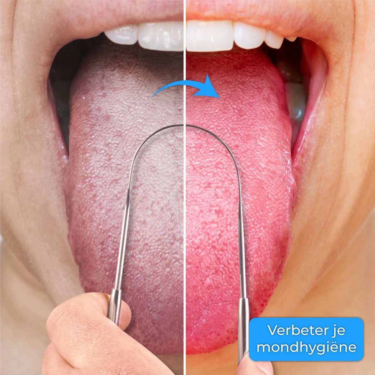 Nuvance - Professionele Tongschraper - 3 In 1 Set - Voor Mondverzorging - Tongreiniger - Tong Schraper - Tongue Scraper - RVS 5 Nuvance - Professionele Tongschraper - 3 In 1 Set - Voor Mondverzorging - Tongreiniger - Tong Schraper - Tongue Scraper - RVS - Afbeelding 3