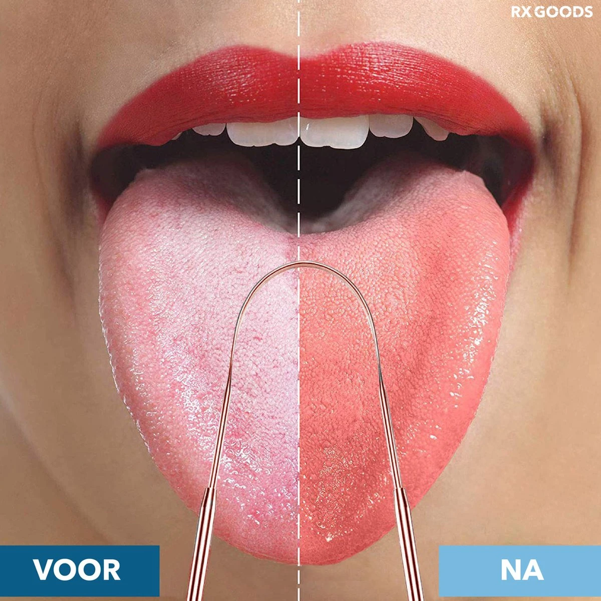RX Goods Rosé Gouden Tongschraper Voor Mondverzorging – 4 Stuks – Duurzaam & Herbruikbaar 4 RX Goods Rosé Gouden Tongschraper Voor Mondverzorging – 4 Stuks – Duurzaam & Herbruikbaar - Afbeelding 2