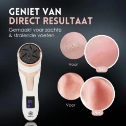 Beeperfect® Elektrische Eeltverwijderaar Met Stofzuigsysteem - Voetvijl - Eeltvijl - IPX7 Waterdicht - Gratis Pedicure Set 16 Beeperfect® Elektrische Eeltverwijderaar Met Stofzuigsysteem - Voetvijl - Eeltvijl - IPX7 Waterdicht - Gratis Pedicure Set -Verzorgingsproducten 1200x1200 137