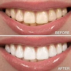 Perfect Wit - Whitening Pen - Tandenblekers - 100% Natuurlijke Ingrediënten - Peroxidevrij - Veilig Bleken - Witte Tanden - Tandbleekset - Tanden Bleken - Whitening - Teeth Whitening - Frisse Adem 16 Perfect Wit - Whitening Pen - Tandenblekers - 100% Natuurlijke Ingrediënten - Peroxidevrij - Veilig Bleken - Witte Tanden - Tandbleekset - Tanden Bleken - Whitening - Teeth Whitening - Frisse Adem -Verzorgingsproducten 1200x1200 1371