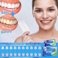 Merkloos Tanden Bleken - Witte Tanden - 5D White Teeth Whitening Strips - Teeth Whitening Strips - 28x Tandenbleek Strips - Zonder Peroxide (0%) -Verzorgingsproducten 1200x1200 1414