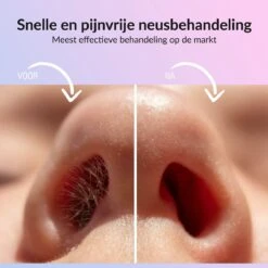 Rivema Luxe Wax Ontharing Set – Neus Ontharing – Wax Beans – Ontharingswax – Ontharen – 7 Maanden Haarvrij 13 Rivema Luxe Wax Ontharing Set – Neus Ontharing – Wax Beans – Ontharingswax – Ontharen – 7 Maanden Haarvrij -Verzorgingsproducten 1200x1200 1788