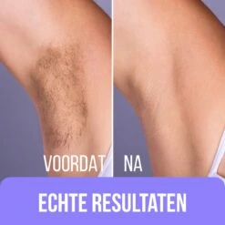 Premium Wax Set Inclusief 400gr Wax Bonen - Pre- & After-Wax Spray - 20 Aanbreng Spatels -Verzorgingsproducten 1200x1200 1803