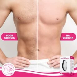 MURLEY’S Crystal Hair Removal - Krystal Remover - Haarverwijderaar - Epilator - Pijnloze En Veilige Ontharing ZWART -Verzorgingsproducten 1200x1200 1834