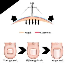 7-Delige Pedicure Set - Nagelverzorging - Nagelset - Ingegroeide Teennagel - Nagelknipper - Nail Clippers - Ingrown Toenail -Verzorgingsproducten 1200x1200 257