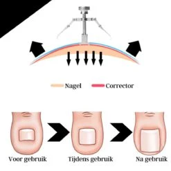 7-delige Pedicure En Manicure Set - Nagelknipper - Pedicureset - Nagelvijl - Nageltang - Kalknagel - Teennagelknipper -Verzorgingsproducten 1200x1200 272