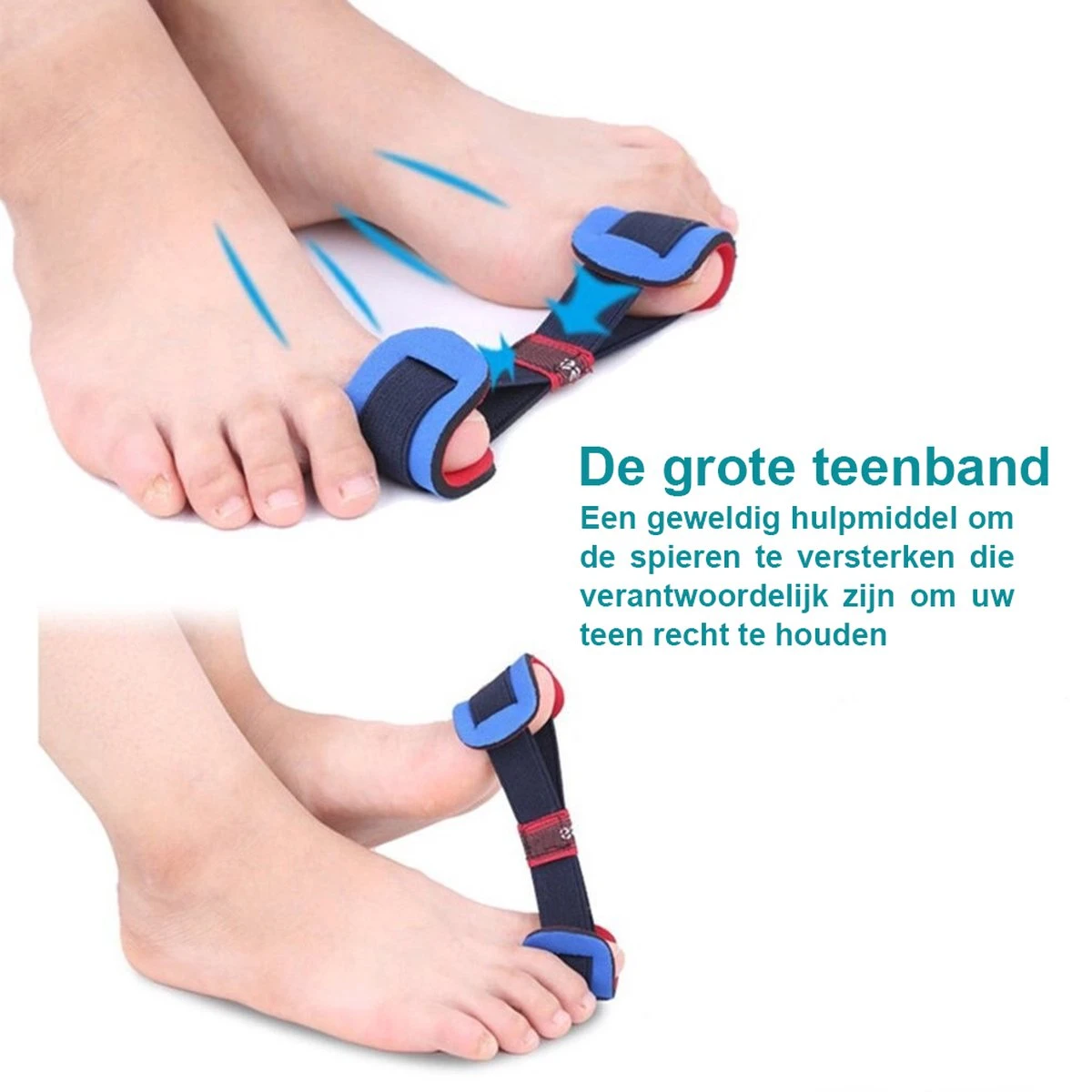 {Feetz} Hallux Valgus Bunion Protector & Corrector - SET VAN 8 STUKS – Voetverzorging & Teenspreider Teenspalk – Voorvoetzolen Siliconen Set Ter Correctie Van Tenenstand. Inclusief Teenband & Massagebal Voor Spierversterkende Oefeningen 6 {Feetz} Hallux Valgus Bunion Protector & Corrector - SET VAN 8 STUKS – Voetverzorging & Teenspreider Teenspalk – Voorvoetzolen Siliconen Set Ter Correctie Van Tenenstand. Inclusief Teenband & Massagebal Voor Spierversterkende Oefeningen - Afbeelding 4