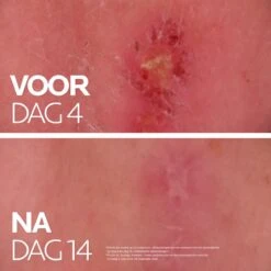 La Roche-Posay Cicaplast Balsem B5+ - 100ml - Voor Gevoelige Huid -Verzorgingsproducten 1200x1200 409