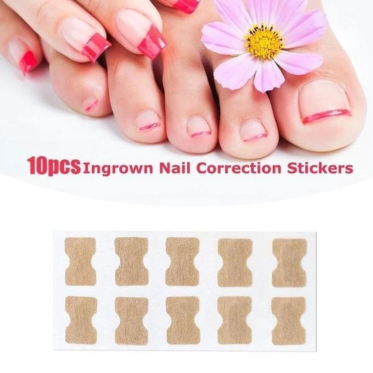 Merkloos Ingegroeide Teennagel Corrector 6 Merkloos Ingegroeide Teennagel Corrector - Afbeelding 4