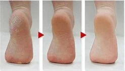 Merkloos Eeltsok- Voetmasker -Eeltsokken - 1xpaar -Verzorgingsproducten 1200x683