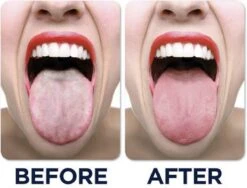 JuliBrite Tong Gel (50 ML) Tongreinigende Gel - Verfrist De Adem - Schone Tong -Verzorgingsproducten 1200x914