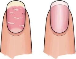 Herome 3 In 1 Manicure Nagelverzorging Set – Beschadigde Nagels – Nagelriemolie, Nagelriemcrème En Nagelverharder -Verzorgingsproducten 1200x925