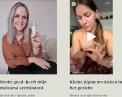 Skinlight Huidbleekcreme - 60ml - Alle Huidtypes - Maakt De Huid Tot 3 Tinten Lichter -Verzorgingsproducten 1200x955