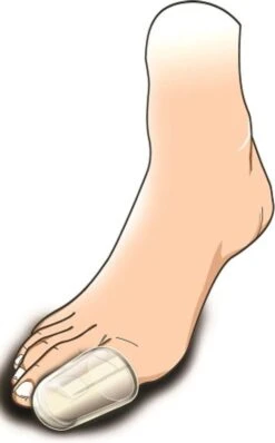 Gel Teenbeschermer (soft Gel) M/L -Verzorgingsproducten 744x1200