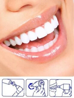 Merkloos HQ Tooth Polisher - Tanden Polijsten - Wittere Tanden - Tandsteen Tandplak Verwijderaar - Elektrisch -Verzorgingsproducten 900x1200 10